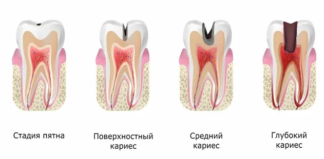 Как выбрать детскую зубную пасту?
